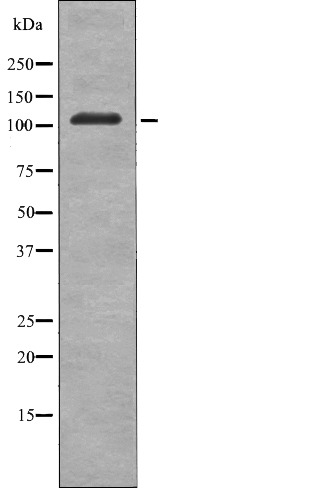 Anti-Phospho-EphB3 (Tyr608) Polyclonal Antibody