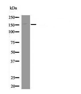 Anti-Phospho-EPRS (Ser999) Polyclonal Antibody