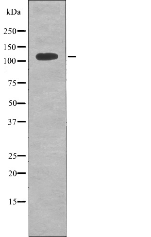 Anti-Phospho-EphB6 (Tyr636) Polyclonal Antibody