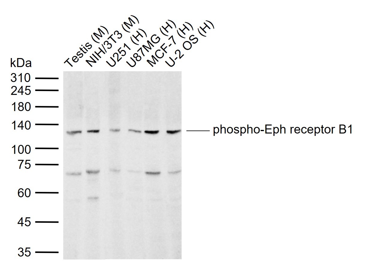 Anti-Phospho-EphB1 (Tyr928) Polyclonal Antibody