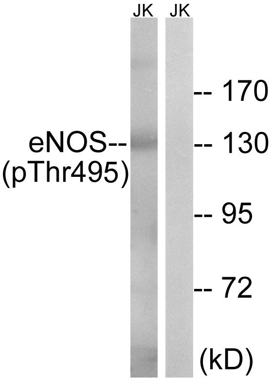 Anti-Phospho-eNOS (Thr495) Polyclonal Antibody