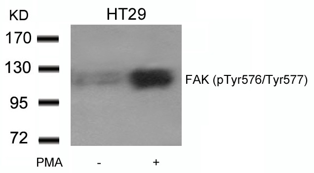 Anti-Phospho-PTK2 (Tyr576, 577) Polyclonal Antibody