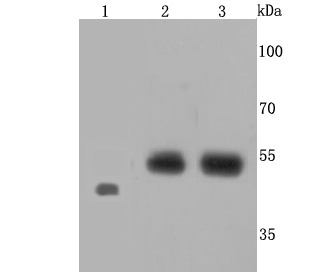 Anti-Endothelin B Receptor Antibody (9N820)