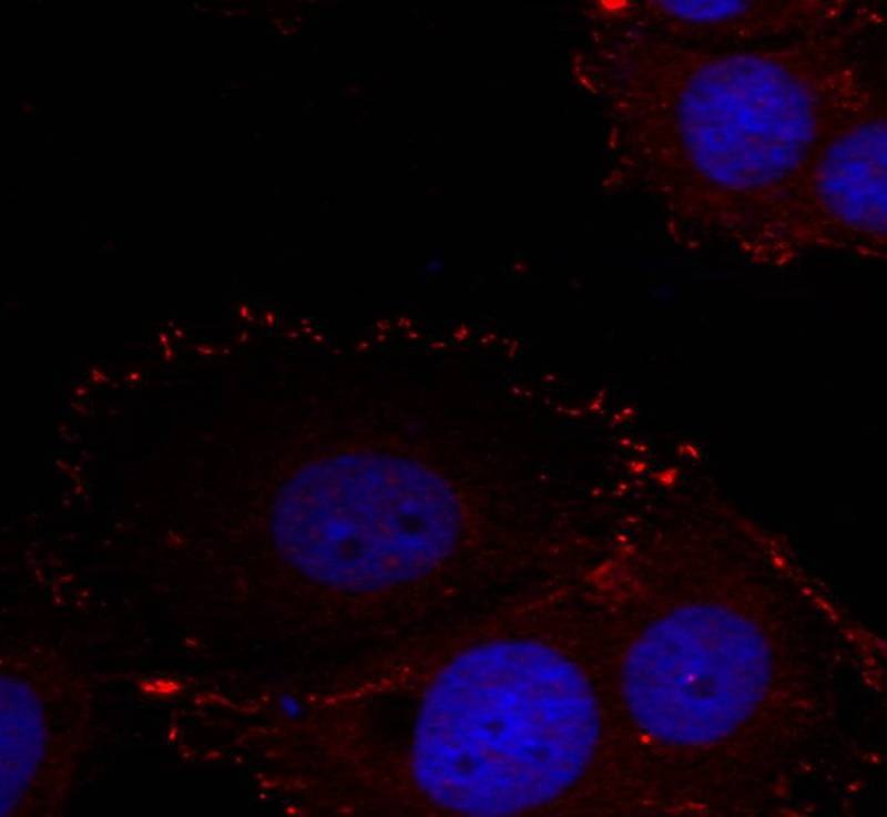 Anti-Phospho-PTK2 (Tyr576, 577) Polyclonal Antibody