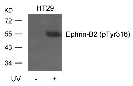 Anti-Phospho-Ephrin B2/EFNB2 (Tyr316) Polyclonal Antibody