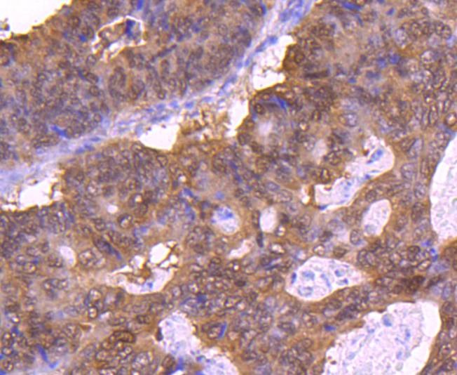 Anti-4EBP1 Antibody (5U577)