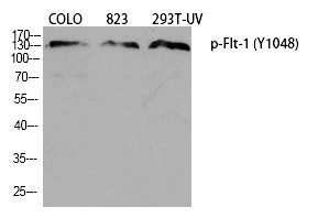 Anti-Phospho-FLT1 (Tyr1048) Polyclonal Antibody 2