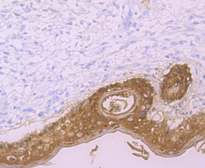 Anti-LGALS7 Antibody (2U199)