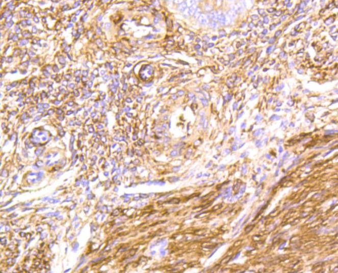 Anti-Filamin-A Antibody (7R224)