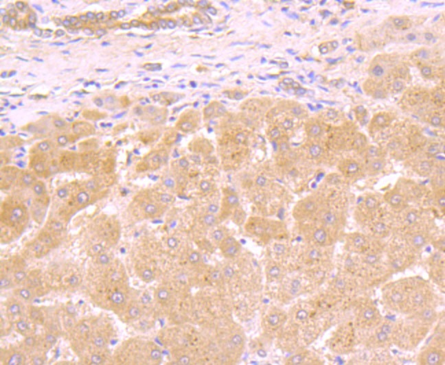 Anti-LGALS8 Antibody (3D467)
