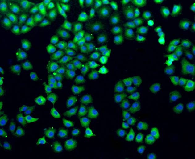 Anti-Filamin-A Antibody (7R224)