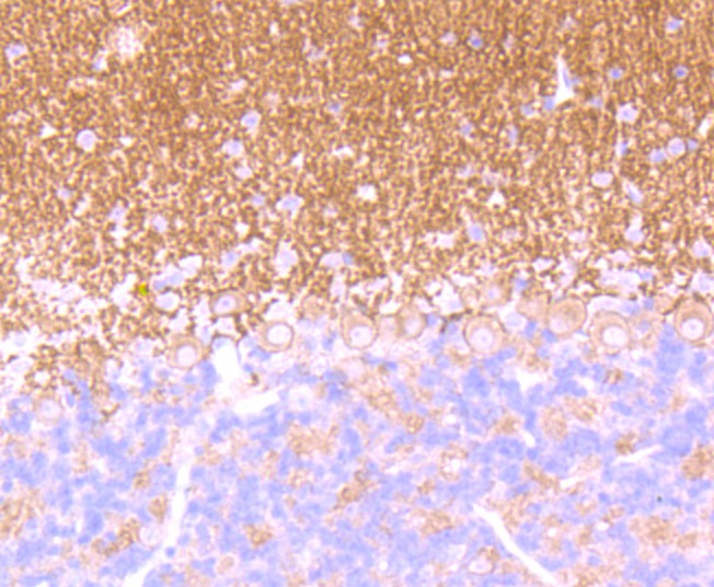 Anti-GABA B Receptor 2 Antibody (7M355)
