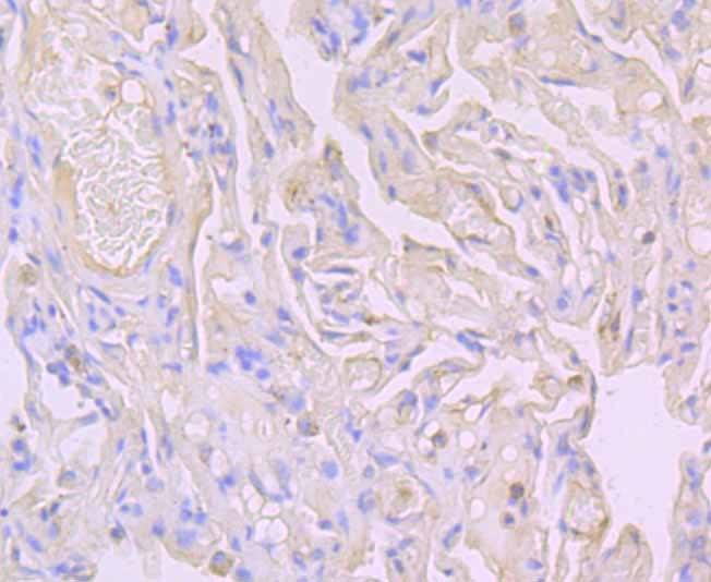Anti-FLOT1 Antibody (9X291)