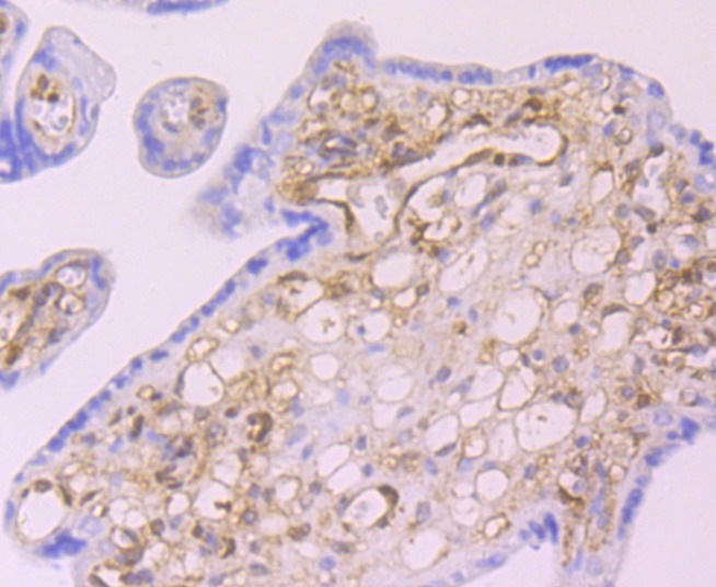 Anti-LGALS1 Antibody (2V443)