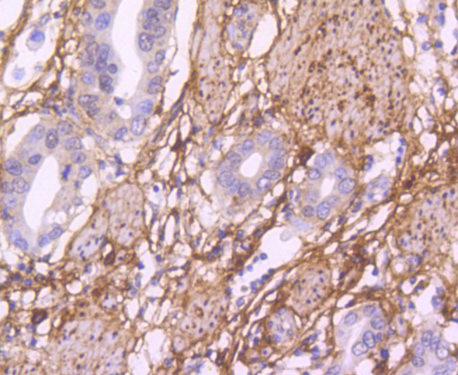 Anti-Fibronectin Antibody (8K938)
