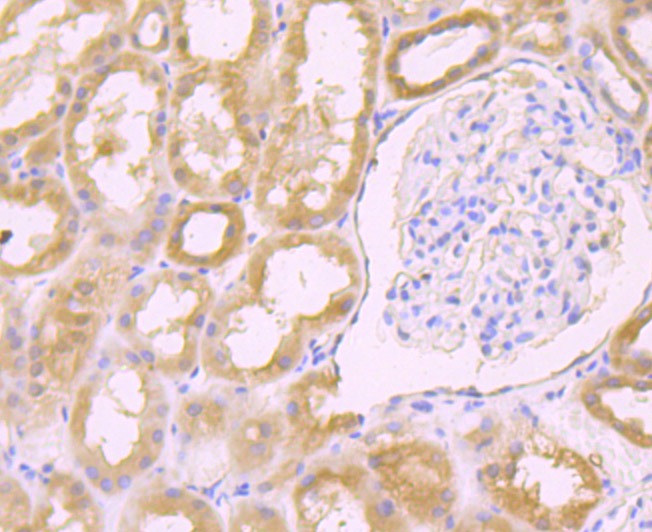 Anti-LGALS8 Antibody (3D467)