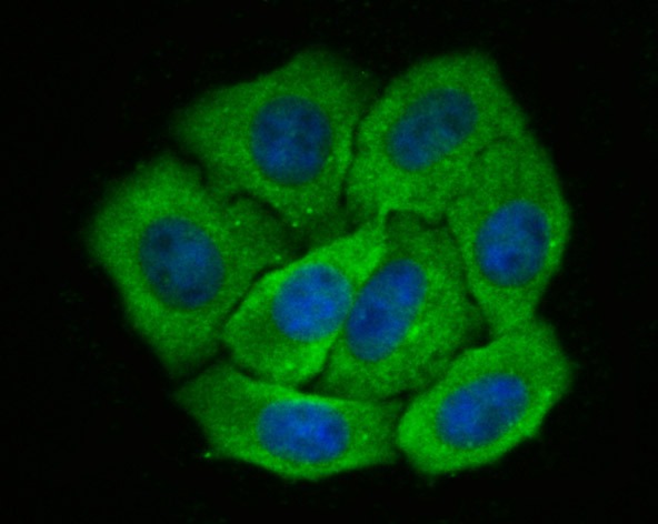 Anti-LGALS8 Antibody (3D467)
