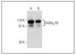 Anti-GABA B Receptor 2 Antibody (1L8)