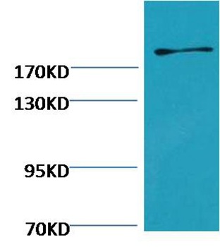 Anti-Fibronectin Antibody (8U653)