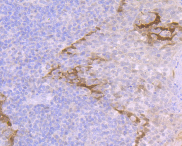 Anti-LGALS7 Antibody (2U199)