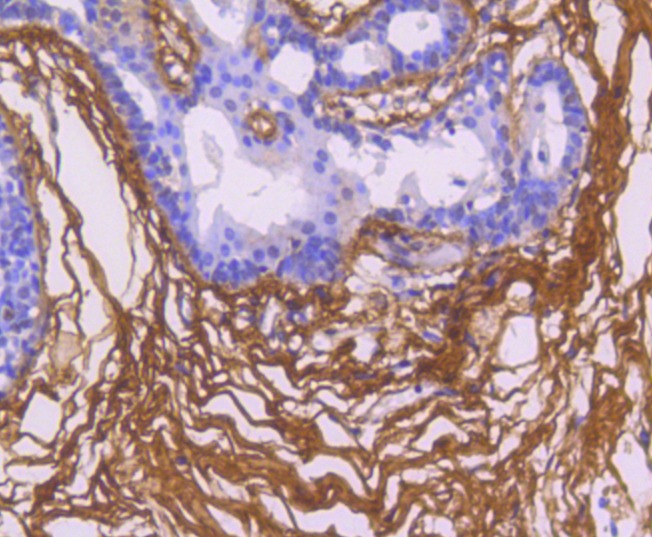 Anti-Fibronectin Antibody (8K938)
