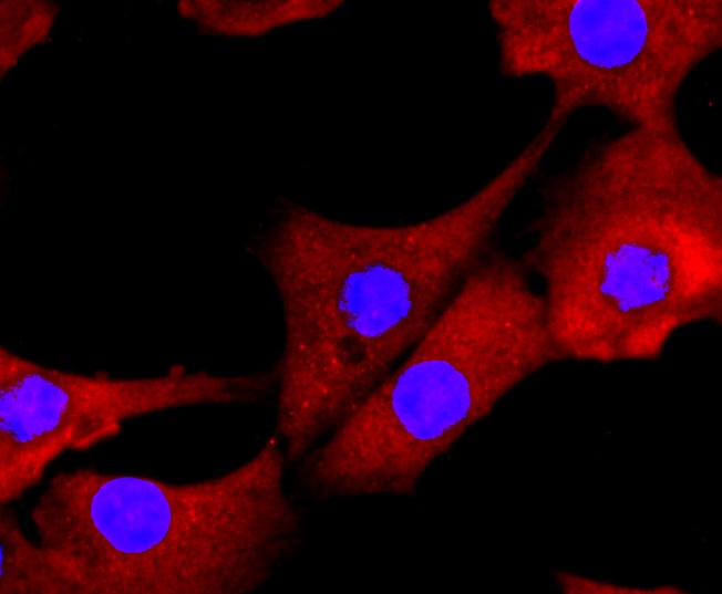 Anti-LGALS3 Antibody (1Z486)