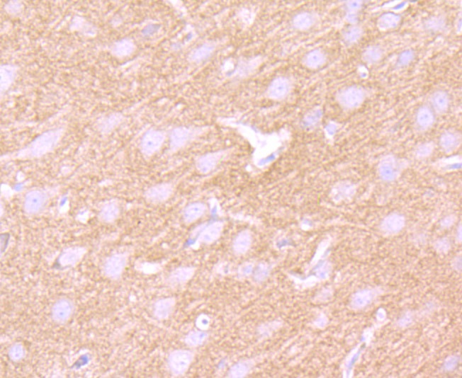 Anti-GABA B Receptor 2 Antibody (7M355)
