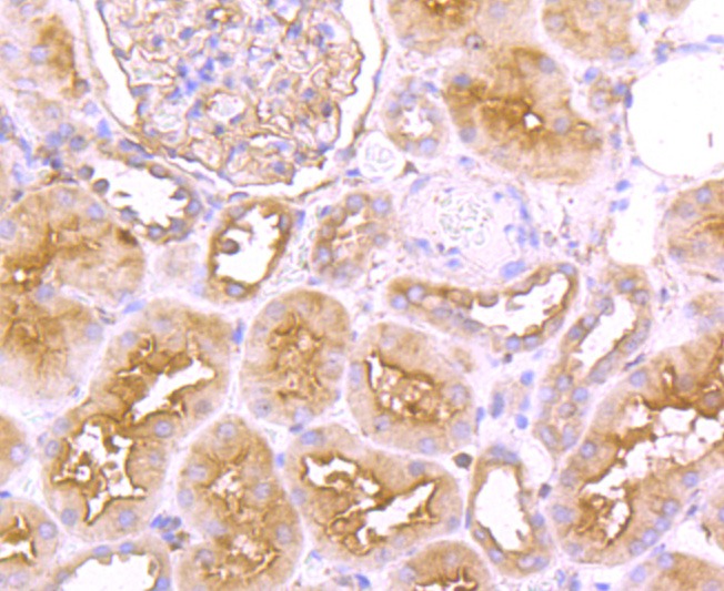 Anti-FGFR3 Antibody (4S518)