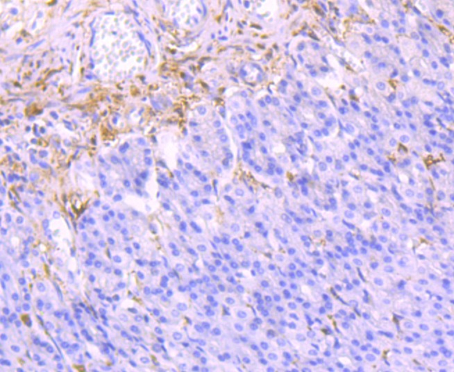Anti-LGALS1 Antibody (2V443)