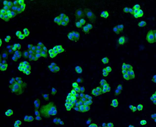 Anti-Filamin-A Antibody (7R224)