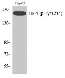 Anti-Phospho-VEGFR2/KDR (Tyr1214) Polyclonal Antibody 2