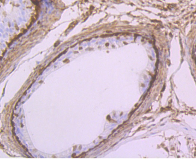 Anti-GSTP1 Antibody (9S908)