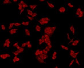 Anti-HSPA5 Antibody (9M857)