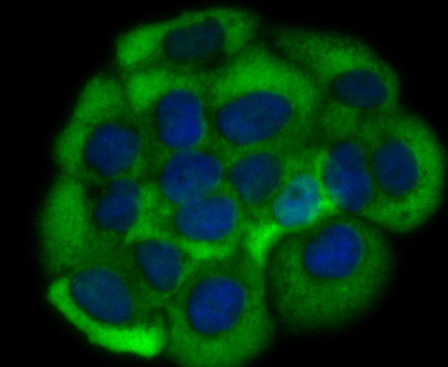 Anti-GHR Antibody (1M753)
