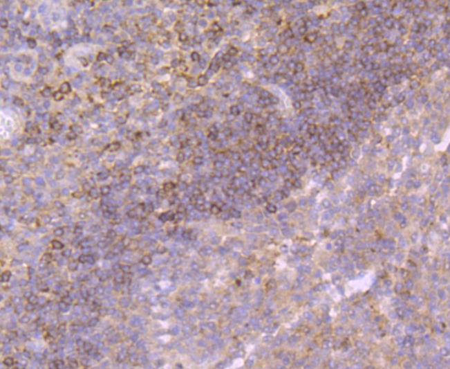 Anti-Growth Hormone Antibody (1Z775)