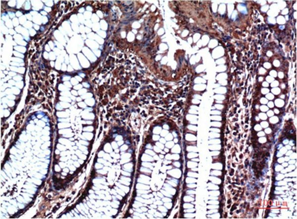 Anti-GSK3B Antibody (2C423)