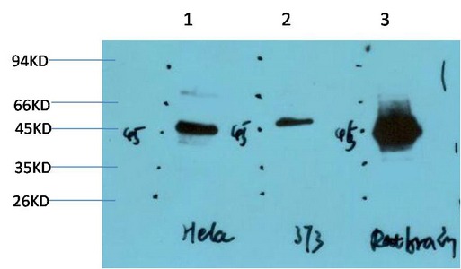 Anti-GSK3B Antibody (7F258)
