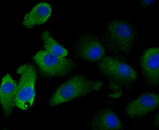 Anti-GSTP1 Antibody (9S908)