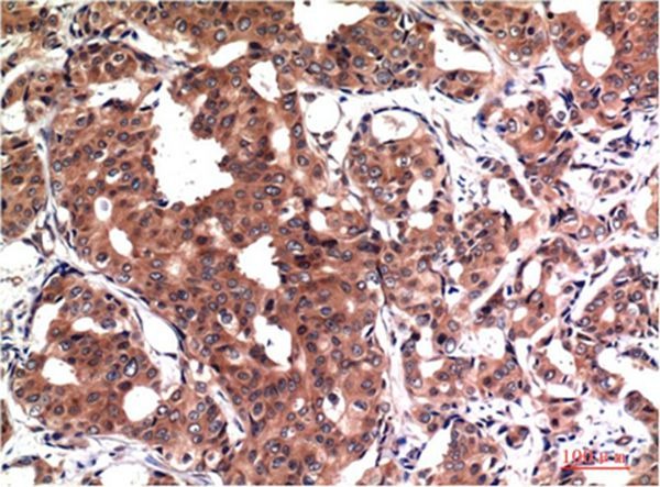 Anti-GSK3B Antibody (2C423)