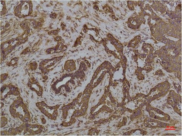 Anti-HSPA5 Antibody (2Y907)