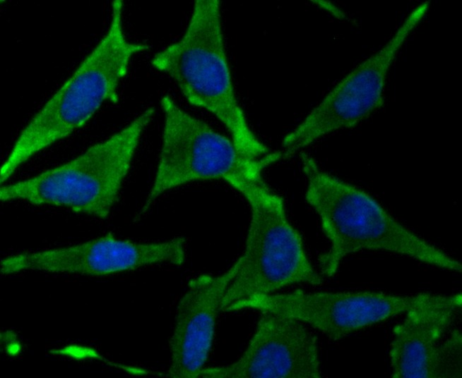 Anti-GHR Antibody (1M753)