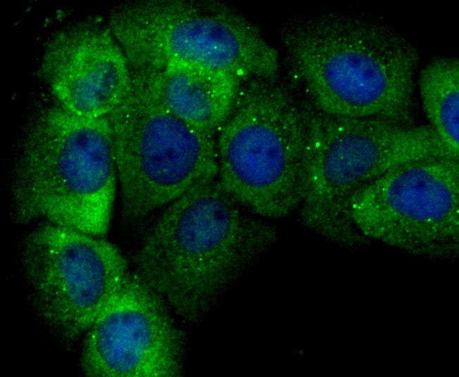 Anti-GSTP1 Antibody (9S908)