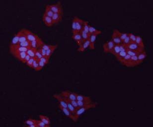Anti-GAPDH Antibody (1V316)