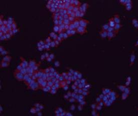 Anti-GAPDH Antibody (1V316)