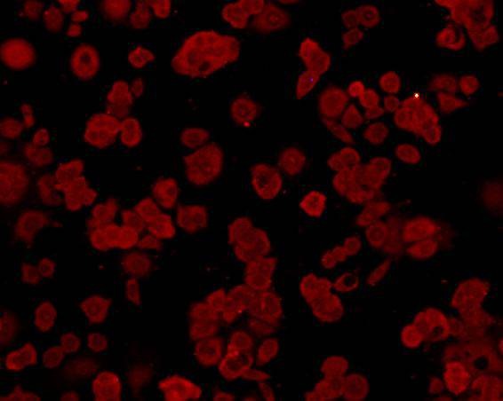 Anti-HSPA5 Antibody (2X960)