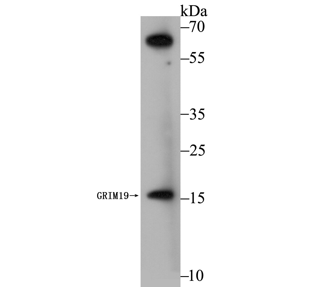 Anti-GRIM19 Antibody (2M560)