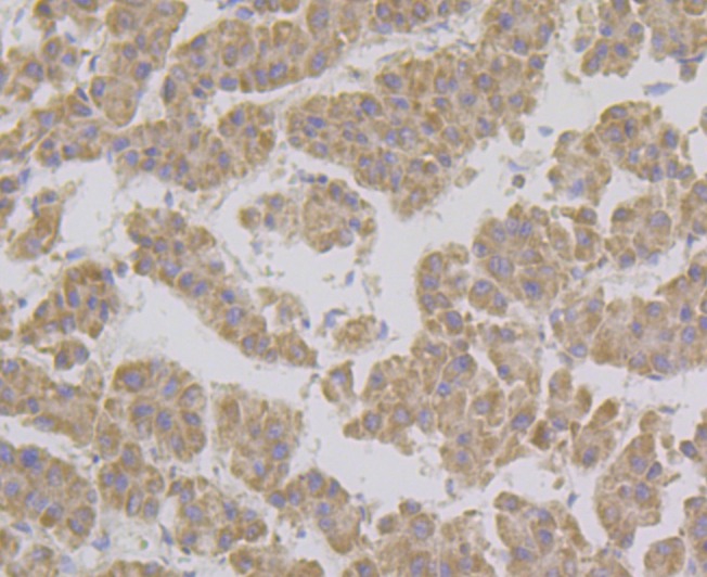 Anti-GRIM19 Antibody (2M560)