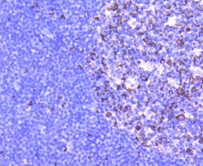 Anti-Glutaminase Antibody (8G424)