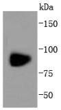 Anti-Glutamate receptor 1 Antibody (3G336)