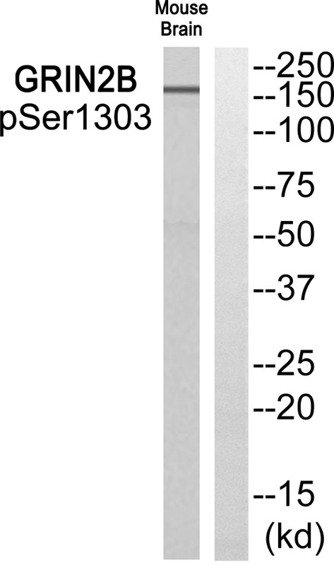 Anti-Phospho-GRIN2B (Ser1303) Polyclonal Antibody
